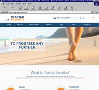 Plantar Fasciitis